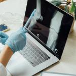 Osteoporosis Menopause