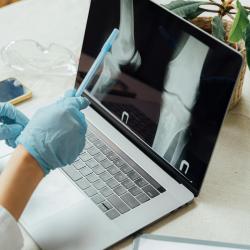 Osteoporosis Menopause